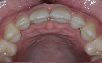 After - Sutton Orthodontics